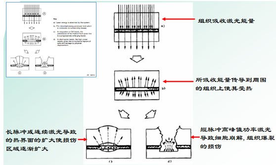 激光投影安全吗？有评价标准吗？ 